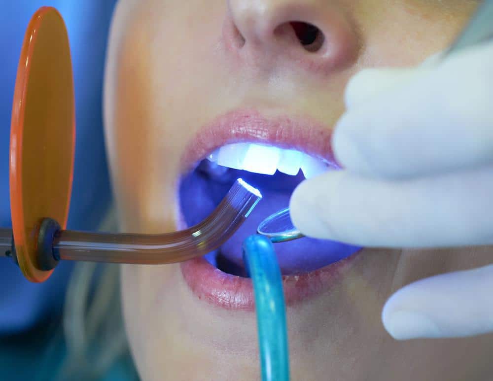 examination of patient's mouth using laser dentistry